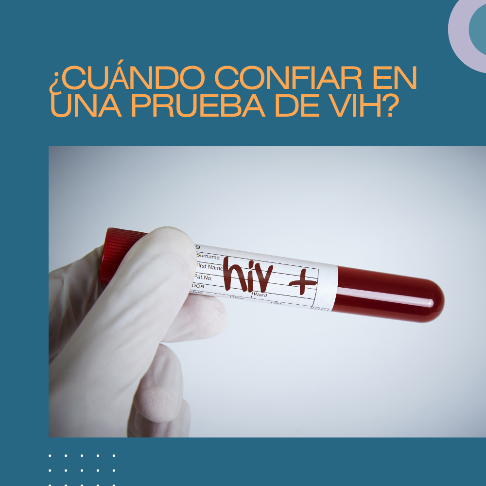 ¿Cuándo confiar en la prueba de VIH?