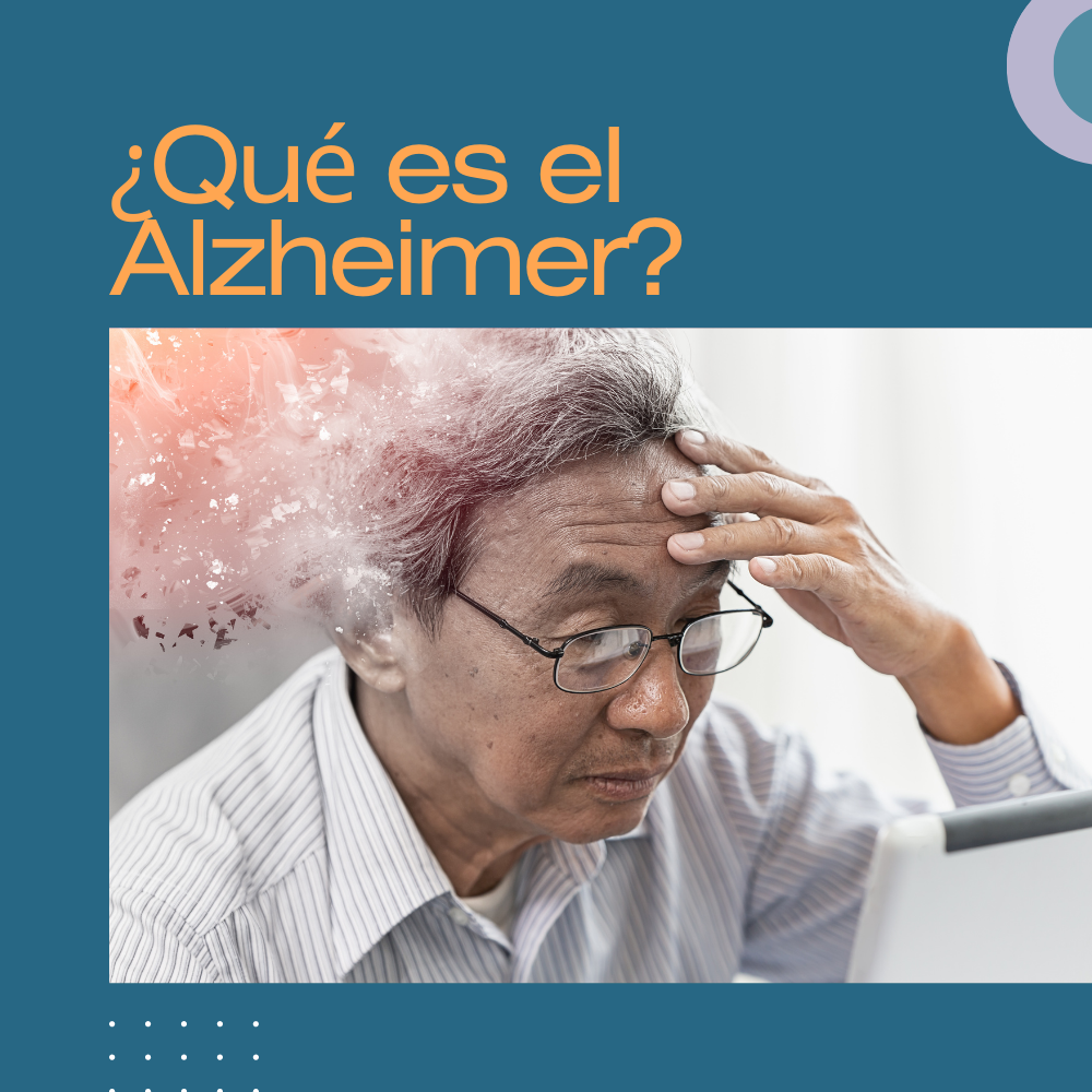 ¿Qué es el Alzheimer?